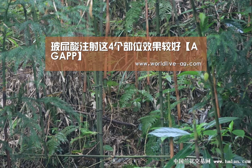 玻尿酸注射这4个部位效果较好【AGAPP】(图1) AG竞猜