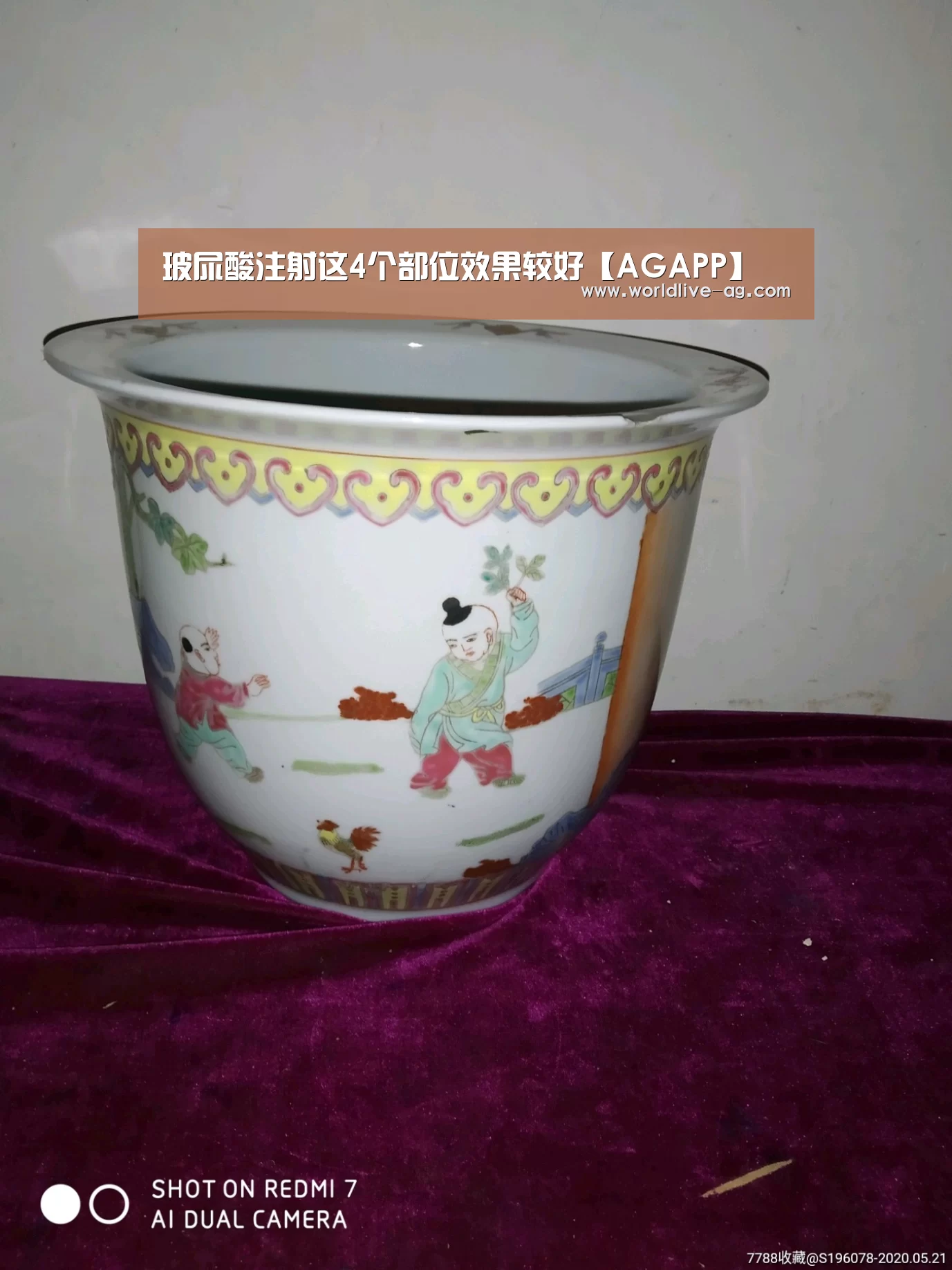 玻尿酸注射这4个部位效果较好【AGAPP】(图2) AG竞猜