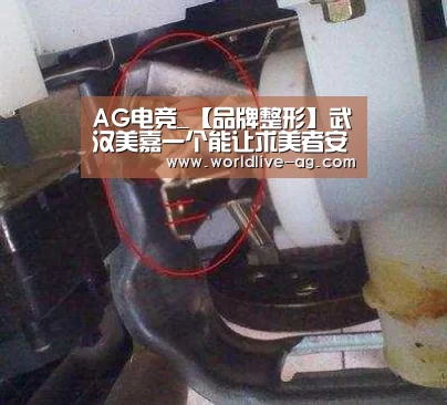 AG电竞_【品牌整形】武汉美嘉一个能让求美者安心放心整形的医院(图2) AG入口
